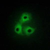 兔抗CSK多克隆抗体