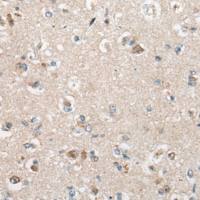 兔抗BCL2L10多克隆抗体