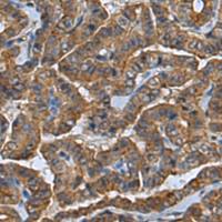 兔抗CLIC2多克隆抗体