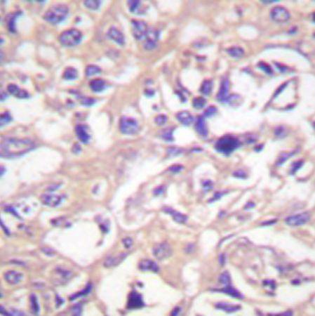兔抗TK1(Ab-13) 多克隆抗体