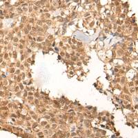 兔抗CLK2多克隆抗体