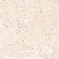 兔抗GRIA1多克隆抗体