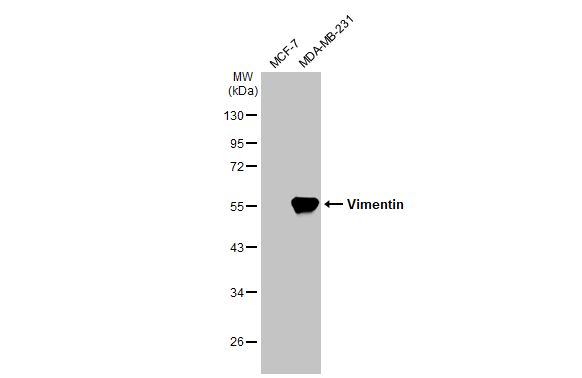 Vimentin antibody [HL1506]