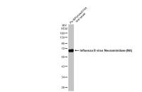Influenza B virus Neuraminidase (NA) antibody [HL1476]