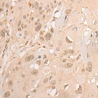 兔抗TRAF4多克隆抗体