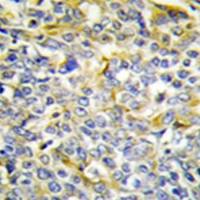 兔抗TNFAIP8多克隆抗体