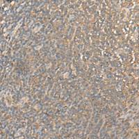 兔抗DGLUCY多克隆抗体