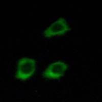 兔抗CLCN4多克隆抗体