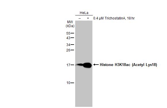 Histone H3K18ac (Acetyl Lys18) antibody [HL1463]