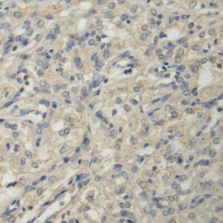 兔抗PPM1A多克隆抗体