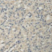 兔抗PPM1A多克隆抗体