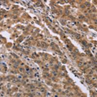 兔抗FAM3B多克隆抗体