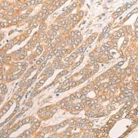 兔抗DCTD多克隆抗体