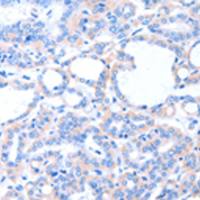 兔抗ACAD8多克隆抗体