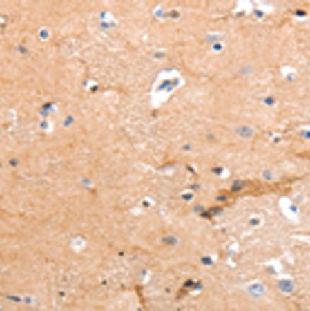 兔抗ADGRG2多克隆抗体