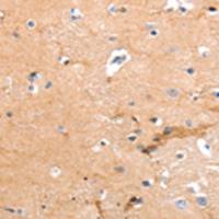 兔抗ADGRG2多克隆抗体