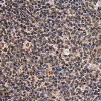 兔抗SIK3多克隆抗体