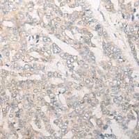 兔抗DDX24多克隆抗体