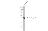 Cardiac Troponin I antibody [HL1489]