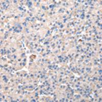 兔抗CHMP3多克隆抗体