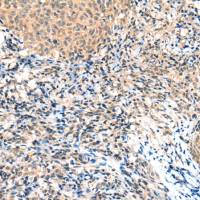 兔抗NCOR2多克隆抗体