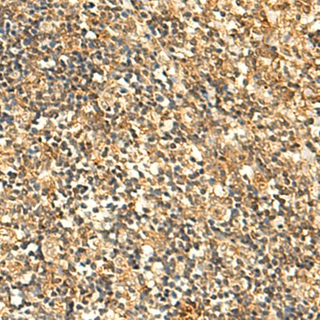 兔抗GLYATL2多克隆抗体