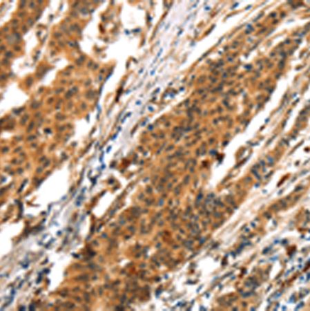 兔抗BCLAF1多克隆抗体