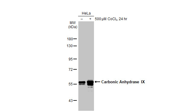 Carbonic Anhydrase IX antibody [HL1410]