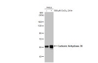 Carbonic Anhydrase IX antibody [HL1410]