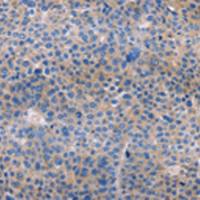 兔抗AMACR多克隆抗体