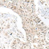 兔抗ASXL1多克隆抗体