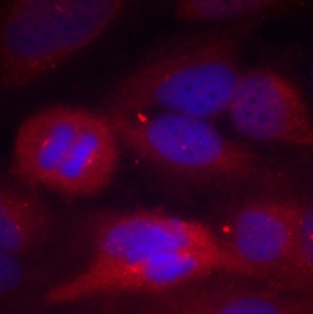兔抗TH(Phospho-Ser40) 多克隆抗体