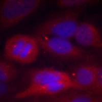 兔抗TH(Phospho-Ser40) 多克隆抗体
