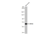RPE65 antibody [HL1519]