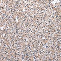 兔抗MRPS30多克隆抗体