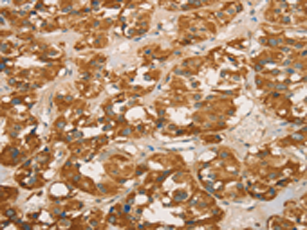 小鼠抗GTF2H1单克隆抗体