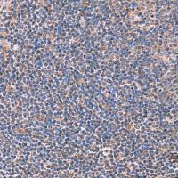 兔抗PEPD多克隆抗体