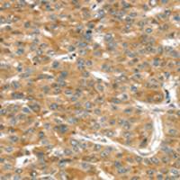 兔抗RASSF9多克隆抗体