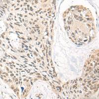 兔抗DNTT多克隆抗体