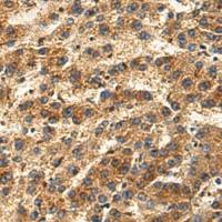 兔抗GP2多克隆抗体