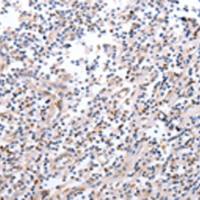 兔抗PDCD10多克隆抗体