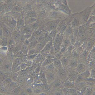 JEG-3绒毛膜癌细胞