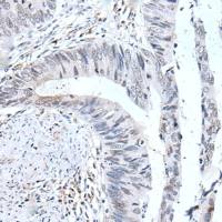 兔抗UBE2T多克隆抗体