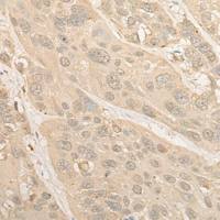 兔抗PSMC4多克隆抗体