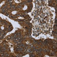 兔抗PPP1R13L多克隆抗体