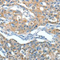 兔抗SERPINA3多克隆抗体