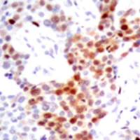 兔抗ATF2 (Phospho-Thr69or51)多克隆抗体