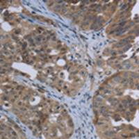 兔抗EPHA10多克隆抗体