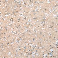 兔抗BBS9多克隆抗体