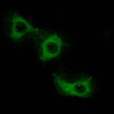 兔抗MRPL44多克隆抗体